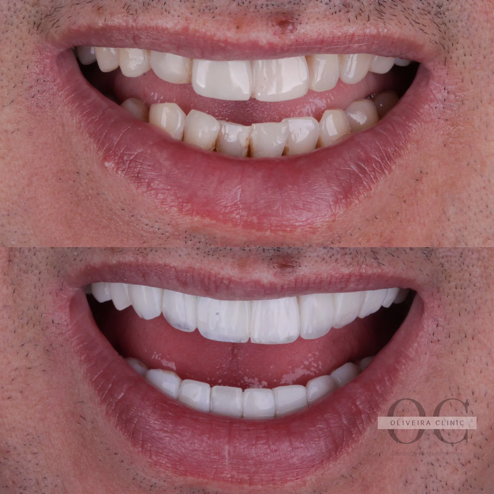 Antes e depois — Reabilitação Masculina na Oliveira Clinic